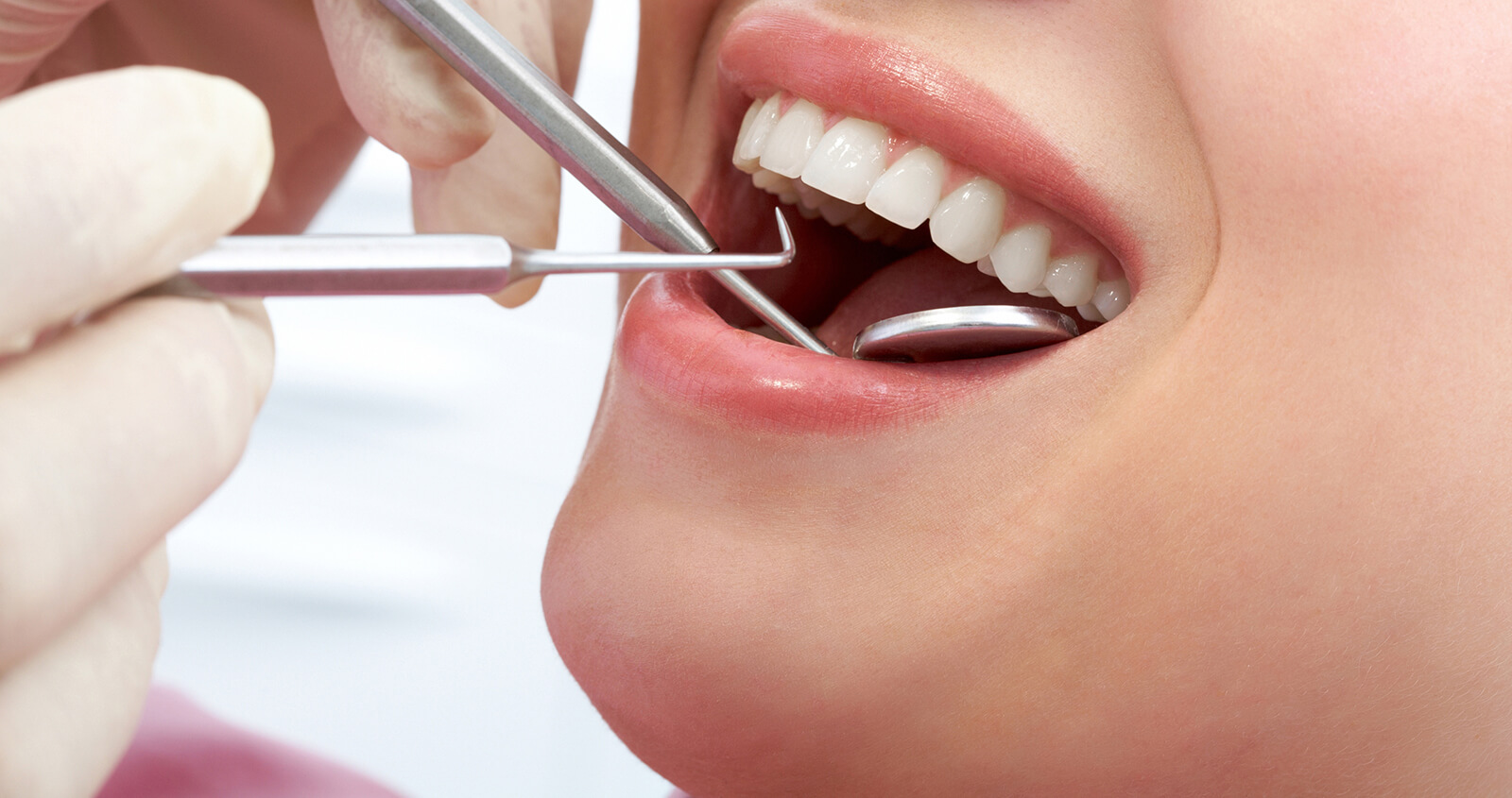 Overland Park, KS dentist explains the mercury removal process for amalgam fillings