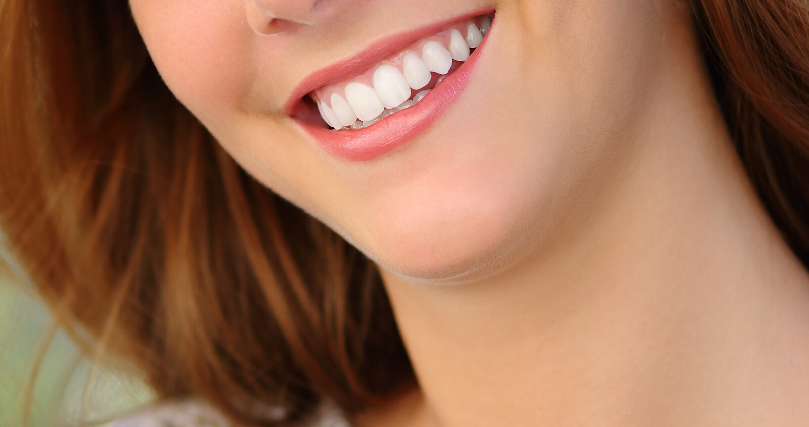 Overland Park dentist provides professional teeth whitening